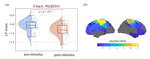 Stimulus-related modulation in the 1/f spectral slope suggests an impaired inhibition during a working memory task in people with multiple sclerosis.
